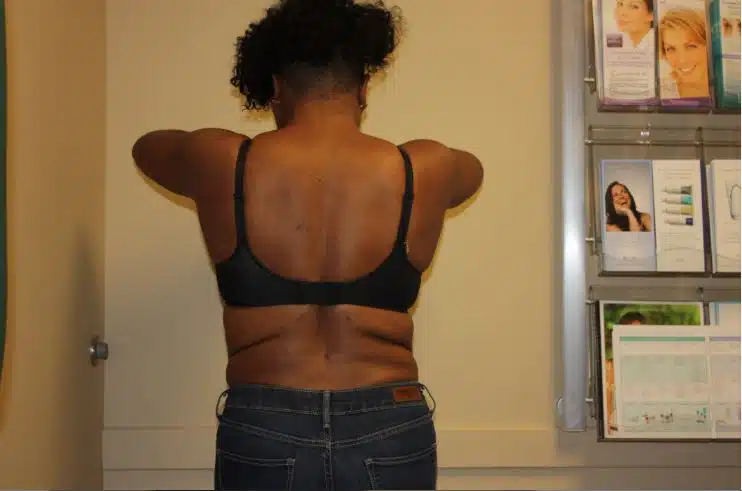 before-photos